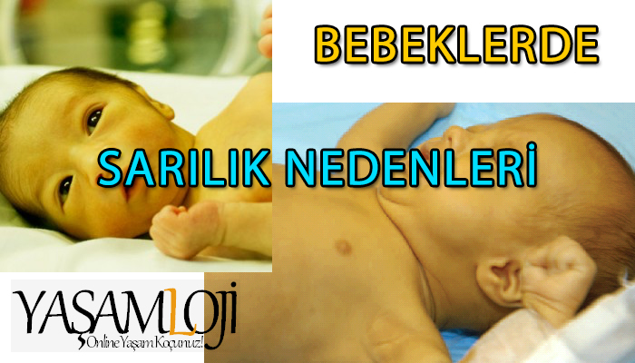 bebeklerde sarılık nedenleri bebeklerde sarılık nedenleri, yeni doğan sarılığı, tedavisi Bebeklerde Sarılık Nedenleri bebeklerde sarilik nedenleri