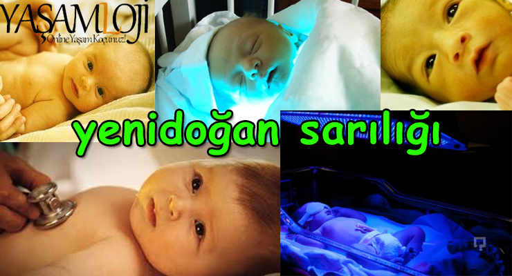 yenidoğan bebeklerde sarılık yenidoğan bebeklerde sarılık Yenidoğan Bebeklerde Sarılık Tedavisi Değerleri yenidogan bebeklerde sarilik